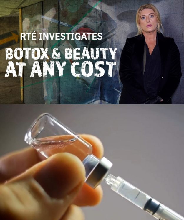 rte botox