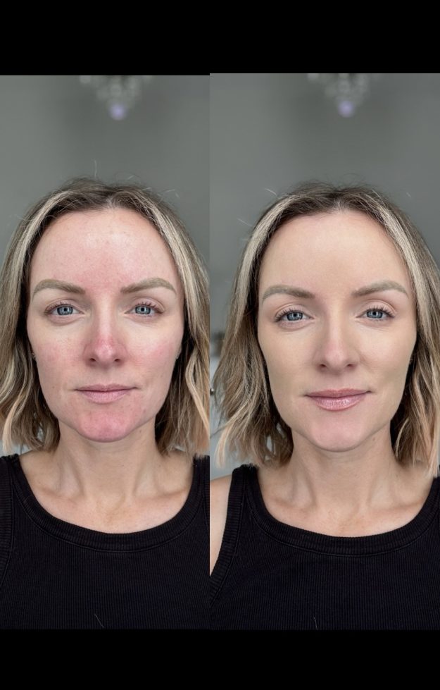 Suzie O’Neill Before & After